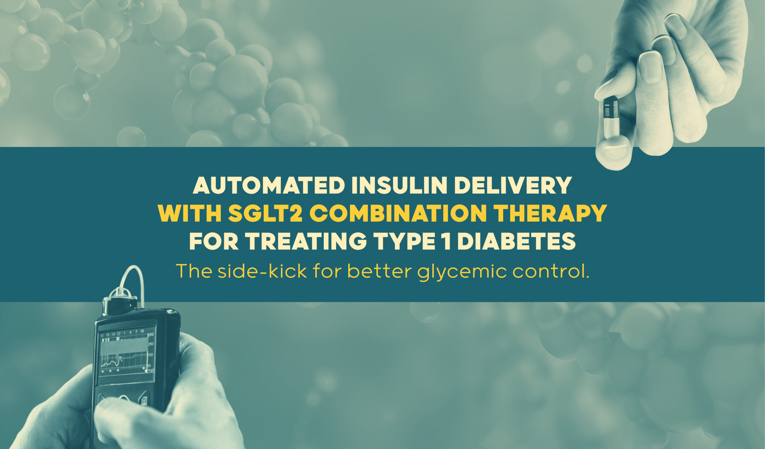 Automated Insulin Delivery with SGLT2i Combination Therapy in Type 1 Diabetes