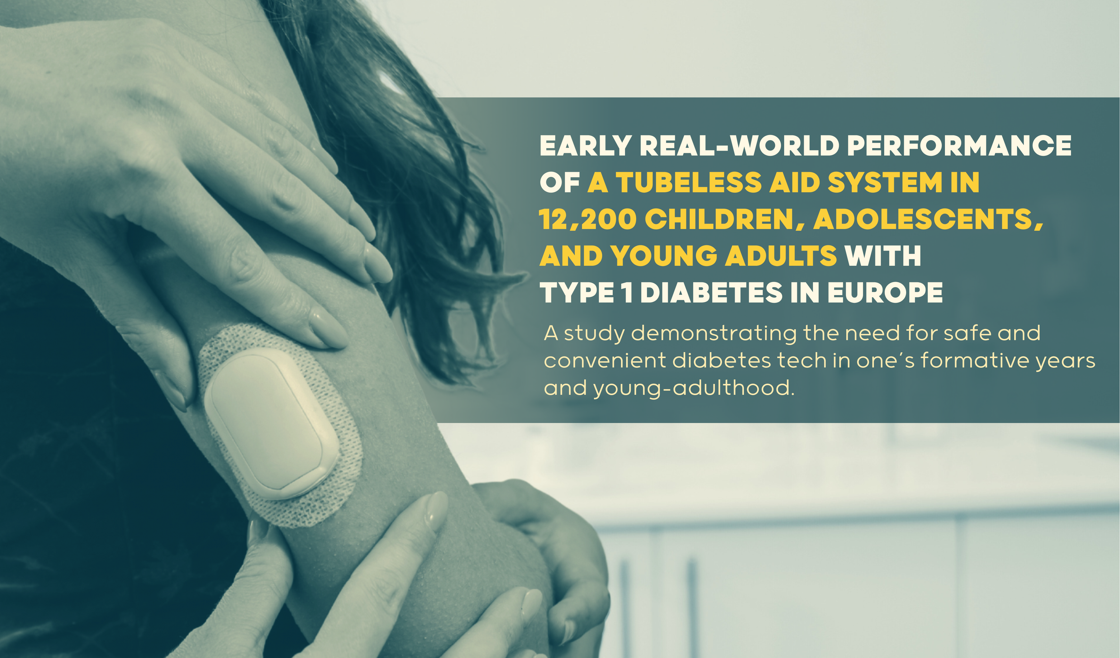 Early Real-World Performance of a Tubeless AID System in 12,200 Children, Adolescents, and Young Adults with Type 1 Diabetes in Europe