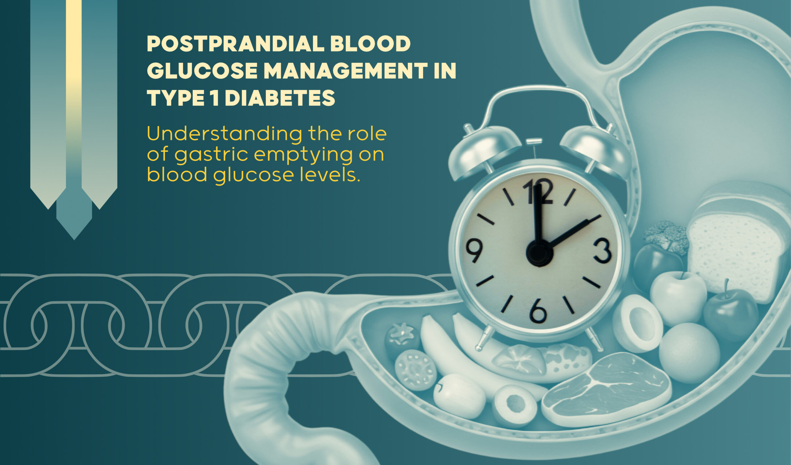 Postprandial Glucose Control in Type 1 Diabetes: Importance of the Gastric Emptying Rate